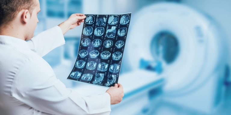 Doctor-looking-MRI-picture -scaled-e1591100669735